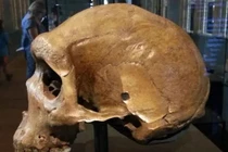 Tại sao lại có lỗ đạn xuất hiện trên các hộp sọ tiền sử?