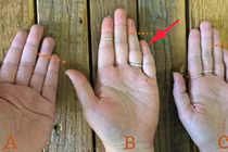 Nhìn độ dài ngón tay út biết ai nhiều phúc lộc