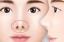 6 nét tướng của người hay gặp xui xẻo, làm ra tiền khó giữ