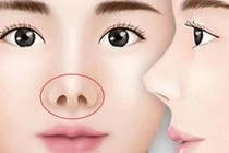 6 nét tướng của người hay gặp xui xẻo, làm ra tiền khó giữ