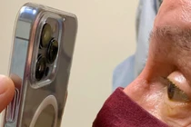 Bác sĩ dùng chiếc iPhone 13 Pro để khám mắt cho bệnh nhân