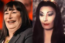 Những ca phẫu thuật thẩm mỹ thất bại của showbiz