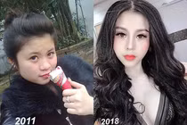 3 hotgirl MXH chi tiền tỉ "đập mặt xây lại", sinh con ra càng lớn càng đẹp lạ kì