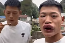 TikToker Trung Quốc bị cấm cửa vì clip ăn ong bắp cày