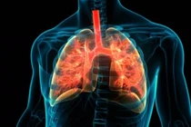 Những bệnh truyền nhiễm gây tử vong nhiều nhất thế giới