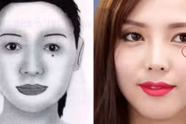 8 nốt ruồi cực xấu khiến bạn cả đời long đong, nghèo khổ 