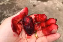 Quả dại kỳ lạ ở Việt Nam: Nhựa chảy đỏ tươi như máu người