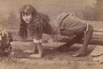 Sốc với top người bị dị tật bẩm sinh khác thường nhất trên thế giới