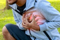 Phân biệt đột tử và đột quỵ