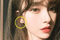 3 nốt ruồi cực phẩm cả đời chẳng lo túng thiếu