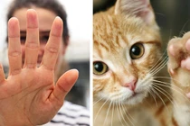 Tại sao con người có 5 ngón tay không phải 4 hay 6 ngón?