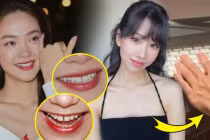 Những sao nữ xinh đẹp, nhưng có khuyết điểm khó khắc phục