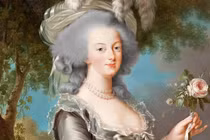 Thực hư căn bệnh khiến tóc đột nhiên bạc trắng