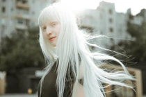 Vẻ đẹp mong manh, thuần khiết tựa hoa tuyết của người mẫu bạch tạng