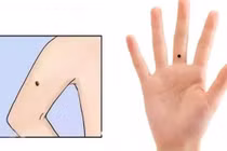 Điểm danh nốt ruồi trên tay tốt hay xấu