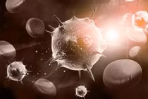 Để tránh bị ung thư "dòm ngó", nên ăn ít 5 loại thực phẩm 