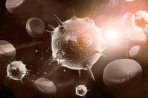 Để tránh bị ung thư "dòm ngó", nên ăn ít 5 loại thực phẩm 