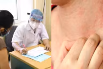 Người tuổi thọ ngắn hay bị ngứa ở 4 vị trí trên cơ thể