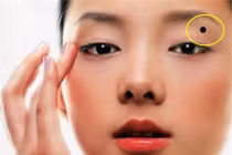 5 nốt ruồi bất ngờ xuất hiện điềm báo xui xẻo cả tiền lẫn tình