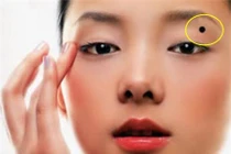 5 nốt ruồi bất ngờ xuất hiện điềm báo xui xẻo cả tiền lẫn tình