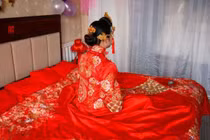 Chồng phát hiện nếp rạn da trên bụng vợ và có hành động lạ