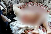 Thương tâm cô gái 20 tuổi nguy kịch vì bị chó hoang tấn công