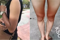 Ám ảnh mùa hè: Giữ da 3 năm ra đường cháy nắng 1 giờ