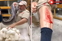 Rùng rợn trăn khổng lồ cắn ngập răng vào người bảo vệ trứng