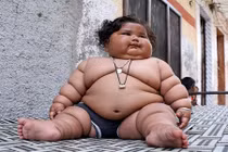 Mắc chứng háu ăn kỳ lạ, bé 8 tháng tuổi nặng 20kg