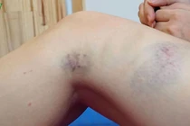 Một phụ nữ nghi bị chồng bạo hành rồi ép quan hệ tình dục dã man