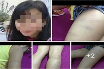 Bắc Ninh: Giáo viên chủ nhiệm đánh học sinh dã man?