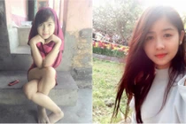 Bất ngờ với nhan sắc thay đổi của hot girl chân khoèo 