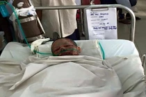 Thương xót cô gái bị bạn trai thiêu sống đã qua đời