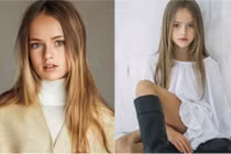 Thiên thần nhí đẹp nhất thế giới giờ ra sao?