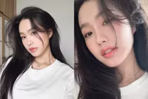 Đôi môi hiện tại của nàng WAGs Doãn Hải My giờ ra sao?