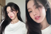 Đôi môi hiện tại của nàng WAGs Doãn Hải My giờ ra sao?