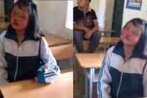 Phẫn nộ clip nữ sinh Mộc Châu tát bạn hộc máu mũi