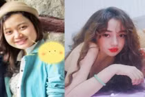 Cô gái 9X gây sốt MXH vì màn lột xác hoàn hảo nhờ phẫu thuật thẩm mỹ