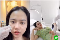 TikToker Bò Chảnh công khai thẩm mỹ, vị trí chỉnh sửa ở đâu? 