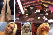 Sự thật đau lòng đằng sau ảnh bị bạo hành của nữ DJ nổi tiếng