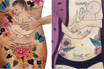 Bộ ảnh “vinh danh” các bà mẹ sinh mổ lay động cộng đồng mạng