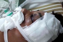 Chạy cảnh sát, người Việt ở Đài Loan rơi từ tầng 4