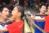 Pha nhổ răng bằng nỏ của cậu bé Việt lên báo Tây