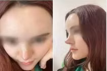 Netizen hết hồn với những pha nâng mũi lạ đời, nhìn như phù thủy