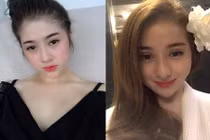 Cô gái xinh đẹp chi 400 triệu “đập đi xây lại” toàn gương mặt