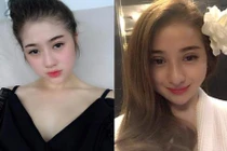 Cô gái xinh đẹp chi 400 triệu “đập đi xây lại” toàn gương mặt