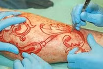 Rợn người kiểu xăm khoét thịt của giới trẻ