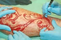 Rợn người kiểu xăm khoét thịt của giới trẻ