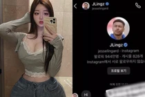 "Cựu nhân viên ngân hàng" siêu vòng 3 khiến Jesse Lingard tẽn tò