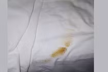 Phẫn nộ cặp vợ chồng thuê khách sạn 5 sao lại còn “phóng uế” lên giường